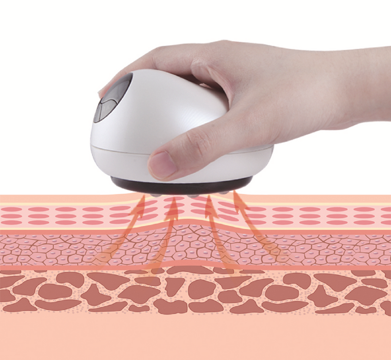 Maxcare Max Cupping